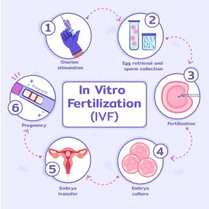 Read more about the article What Does IVF Stand For? Your Ultimate Guide to In Vitro Fertilization