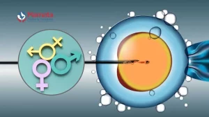 Read more about the article Can You Choose Your Baby’s Gender with IVF? The Ultimate Guide