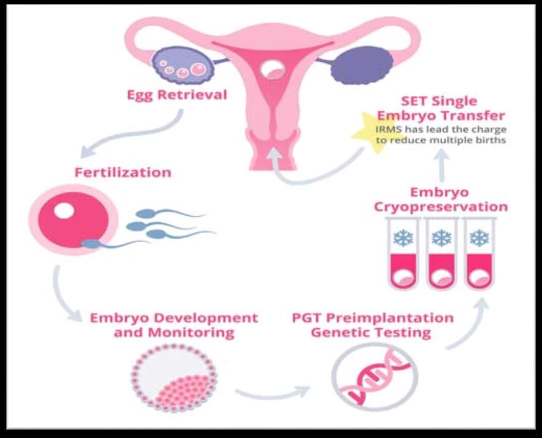 Read more about the article What Are the 5 Stages of IVF? Your Complete Guide to the Journey