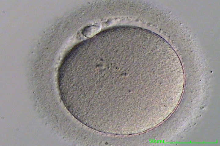 Read more about the article How Eggs Are Retrieved in IVF: A Deep Dive Into the Process