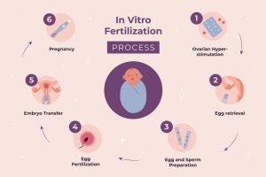 Read more about the article What Is IVF Meaning? Your Ultimate Guide to In Vitro Fertilization