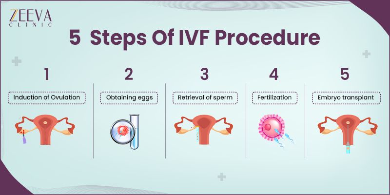 You are currently viewing What Are IVF Injections? Your Ultimate Guide to Understanding This Fertility Step