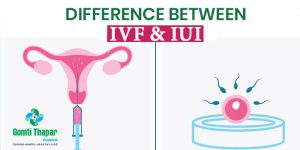 Read more about the article What’s the Difference Between IUI and IVF? Your Ultimate Guide to Fertility Treatments