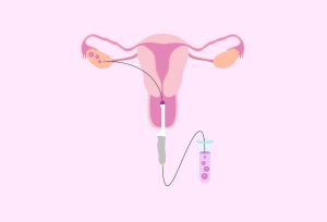 Read more about the article How Many Eggs Are Collected in IVF? Your Ultimate Guide to Understanding the Process