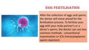 Read more about the article How Are Eggs Harvested for IVF? A Deep Dive Into the Fascinating Process