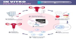 Read more about the article How Long Does an IVF Cycle Take? Your Complete Guide to the IVF Timeline