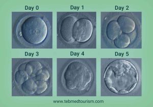 Read more about the article How Long Does IVF Take from First Appointment?
