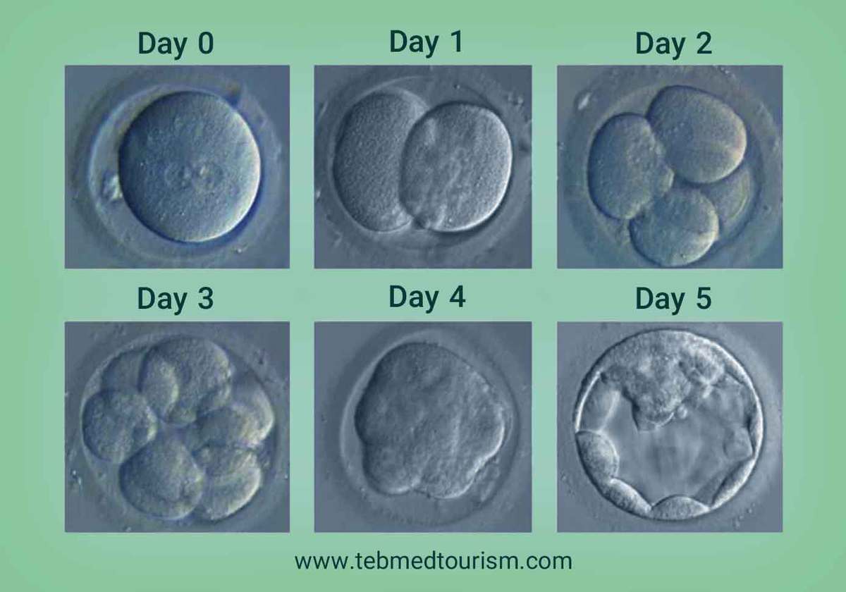You are currently viewing How Long Does IVF Take from First Appointment?