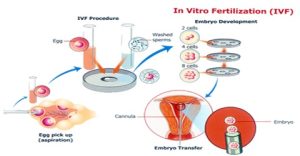 Read more about the article Is IVF a Mortal Sin? Exploring the Ethics, Science, and Personal Stories Behind In Vitro Fertilization