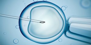 Read more about the article Does IVF Increase the Risk of Cancer?