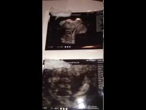 Read more about the article How to Figure Out Your Due Date with IVF: A Fun, Simple, and Deep Dive Guide