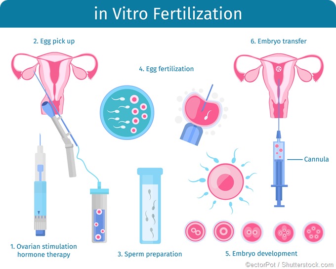 You are currently viewing How Many Embryos Are Implanted in IVF? A Deep Dive into the Process