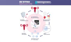 Read more about the article How Long Does the IVF Procedure Take?