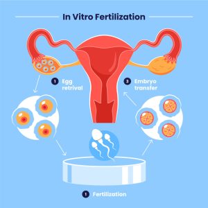 Read more about the article Does IVF Freeze Eggs or Embryos? Your Ultimate Guide to Understanding the Process