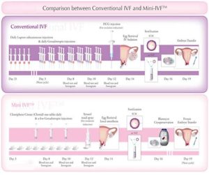 Read more about the article What Is Mini IVF? Your Ultimate Guide to This Lesser-Known Fertility Option