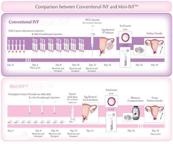 Read more about the article What Is Mini IVF? Your Ultimate Guide to This Lesser-Known Fertility Option