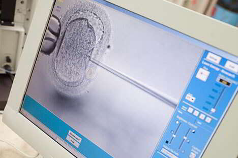You are currently viewing What Does IVF Stand For in Medical Terms?