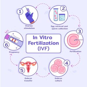 Read more about the article What Is ERA in IVF? Your Ultimate Guide to Unlocking Fertility Secrets